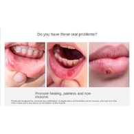 Діодна лазерна терапія пародонту